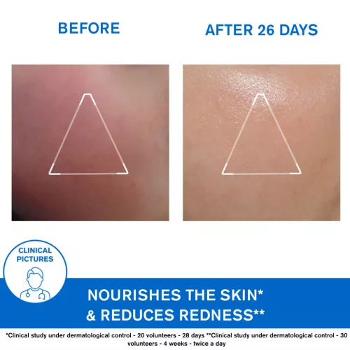 Uriage Xémose C8+ tápláló, hidratáló arckrém 40ml