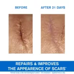 Uriage Bariéderm-Cica CU-ZN krém 40ml