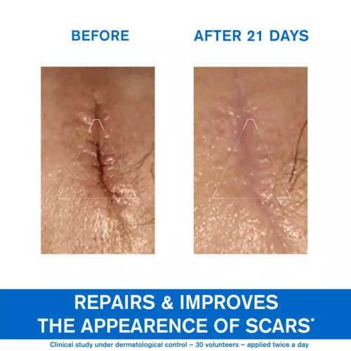 Uriage Bariéderm-Cica CU-ZN krém 40ml