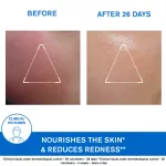 Uriage XÉMOSE Cerat lipidpótló ápoló krém 200ml