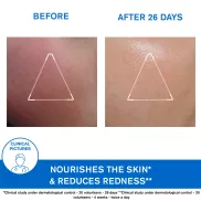 Uriage XÉMOSE Cerat lipidpótló ápoló krém 200ml