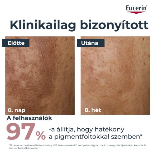 Eucerin Anti-Pigment Nappali arckrém SPF30 50ml