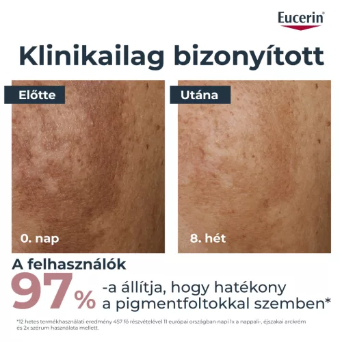 Eucerin Anti-Pigment Dual szérum 30ml
