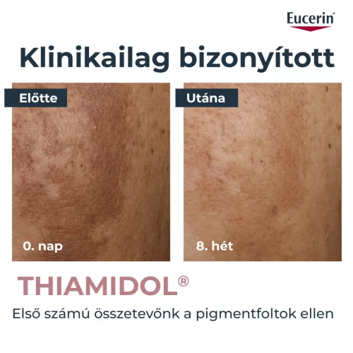 Eucerin Anti-Pigment bőrtökéletesítő szérum 30ml