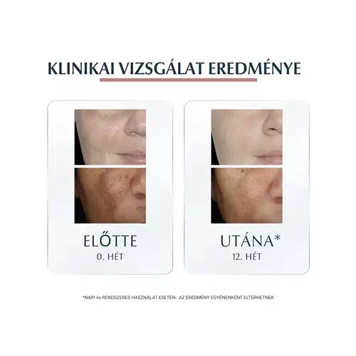 Eucerin Anti-Pigment színezett nappali arckrém medium SPF30 50ml