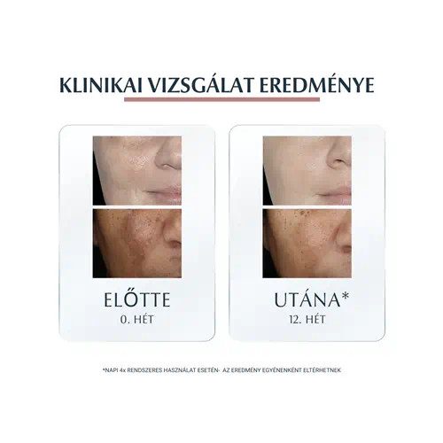 Eucerin Anti-Pigment színezett nappali arckrém light SPF30 50ml