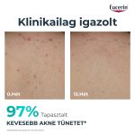 Eucerin DermoPure Clinical Testkrém 200 ml