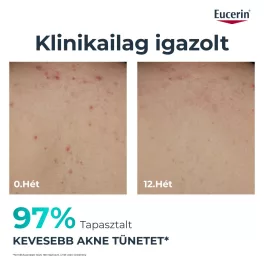 Eucerin DermoPure Clinical Testkrém 200 ml