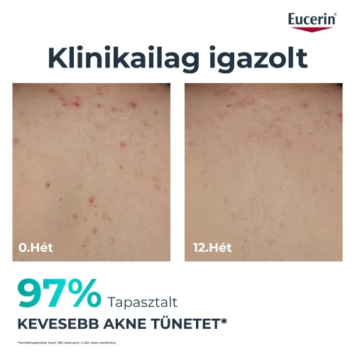 Eucerin DermoPure Clinical Testkrém 200 ml