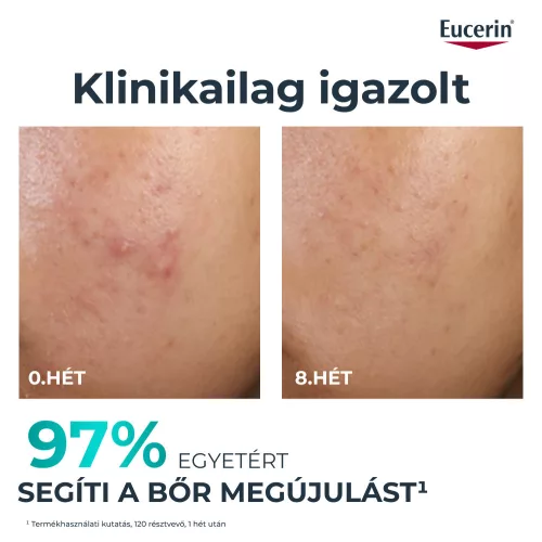 Eucerin DermoPure Clinical Peeling 10 Bőrmegújító Szérum 40ml