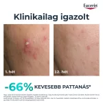 Eucerin DermoPure Clinical Triple Action Korrektív Fluid 40 ml