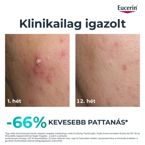 Eucerin DermoPure Clinical Triple Action Korrektív Fluid 40 ml