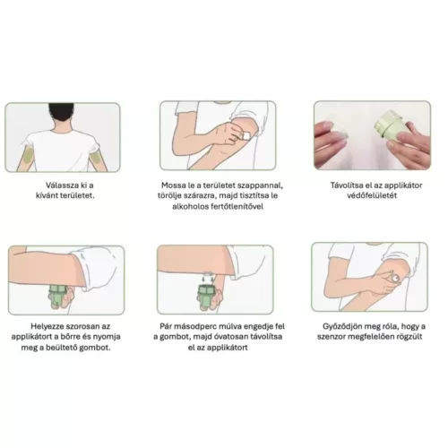 MicroTech LinX szenzor folyamatos vércukormérő